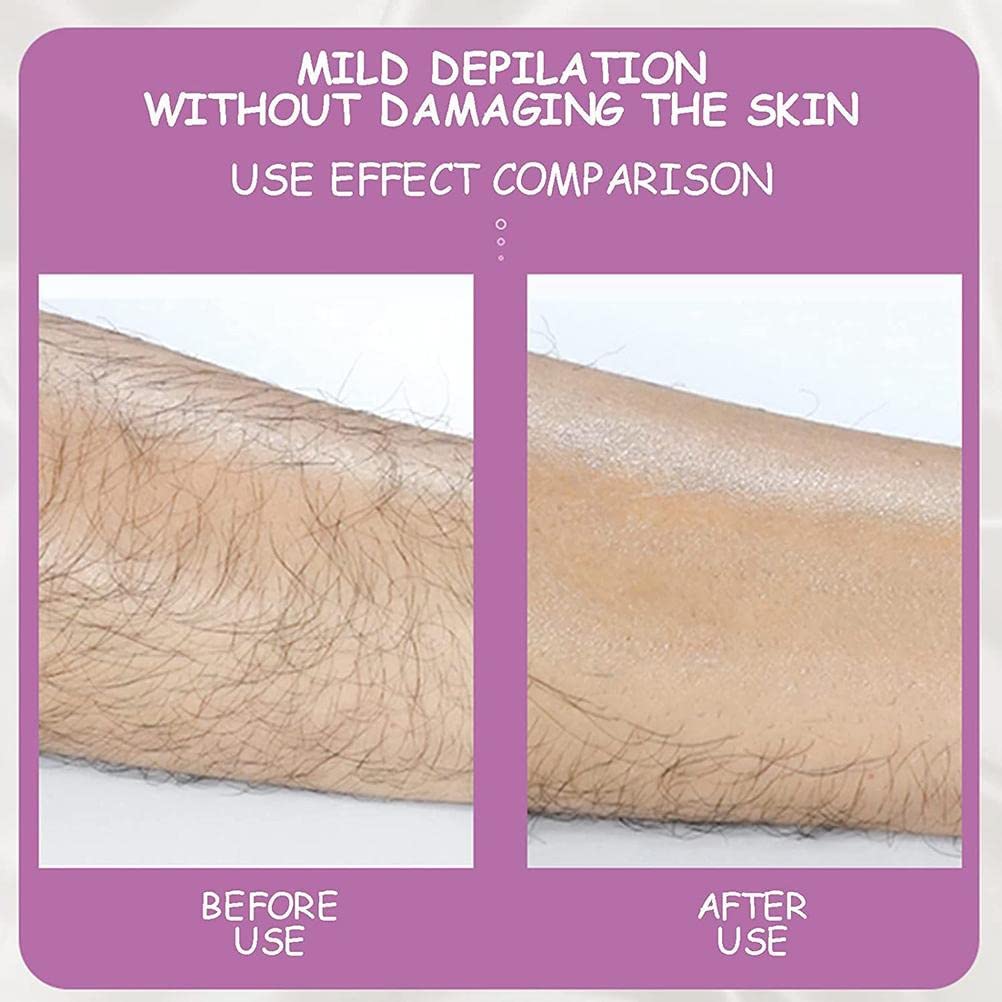 SOFT-SKIN EPILATORE ESFOLIANTE SENZA DOLORE